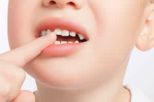 stock photo of a child showing their teeth